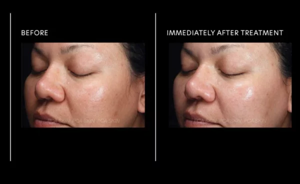 PCA SKIN Micro Peel At-Home Kit - Image 5